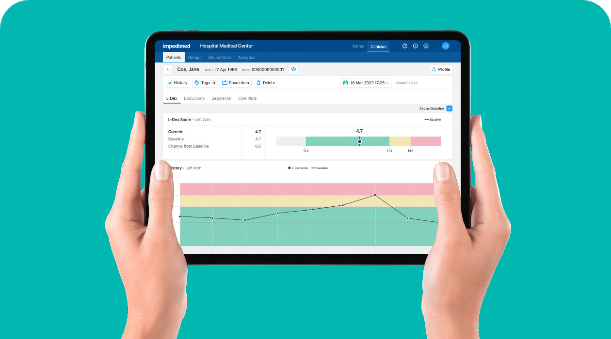 L-Dex Analysis